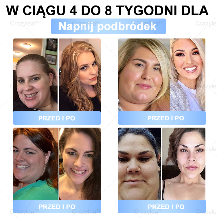 🔥 Extra 30% kedvezmény + ingyenes gyors szállítás!💚 Akár 12–25 kg fogyás 4–8 hét alatt – természetes, biztonságos és klinikailag tesztelt!✅ 180 napos pénzvisszafizetési garancia – kockázat nélkül!