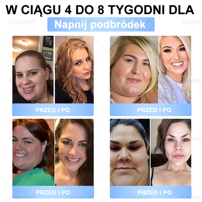 🔥 Extra 30% kedvezmény + ingyenes gyors szállítás!💚 Akár 12–25 kg fogyás 4–8 hét alatt – természetes, biztonságos és klinikailag tesztelt!✅ 180 napos pénzvisszafizetési garancia – kockázat nélkül!