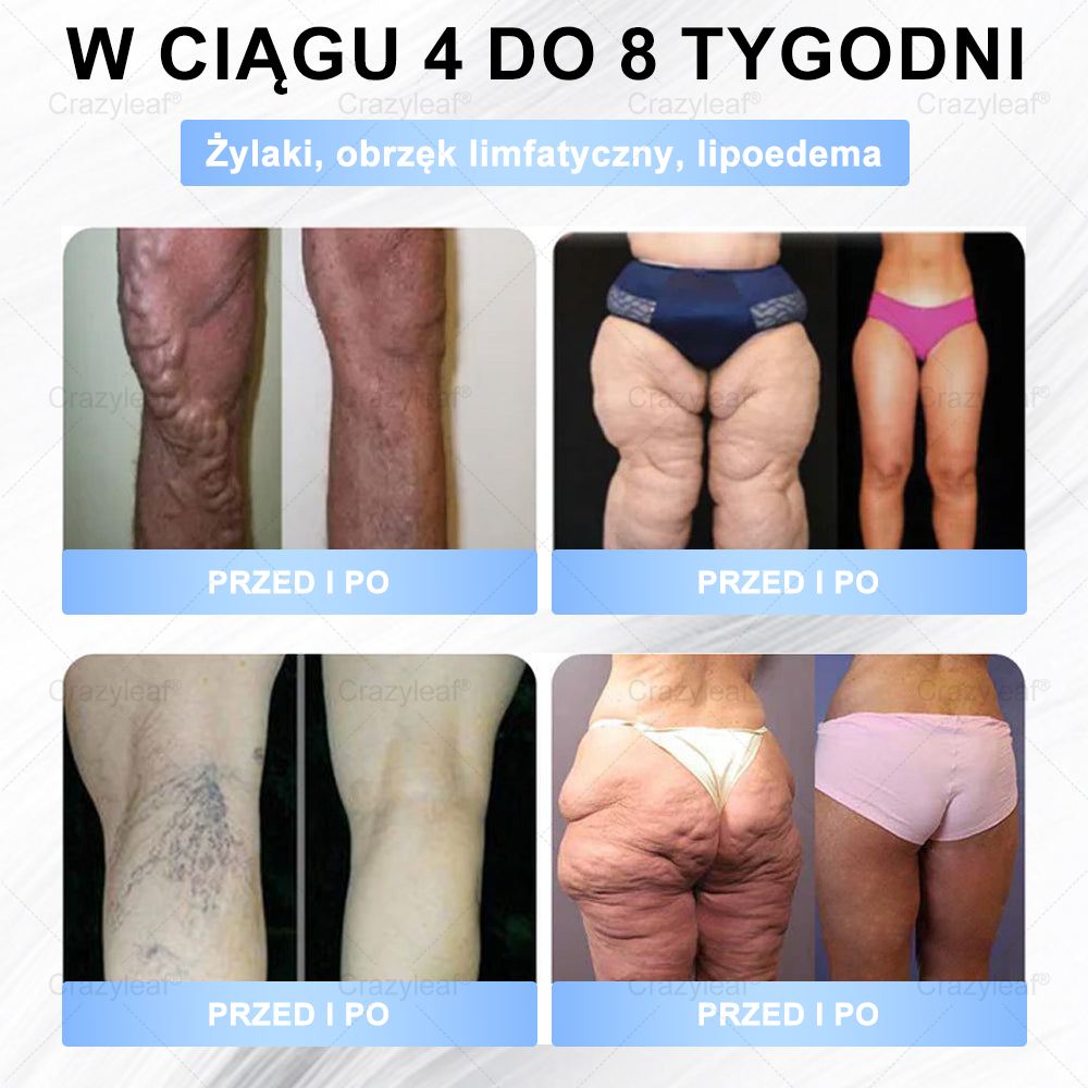 🔥 Extra 30% kedvezmény + ingyenes gyors szállítás!💚 Akár 12–25 kg fogyás 4–8 hét alatt – természetes, biztonságos és klinikailag tesztelt!✅ 180 napos pénzvisszafizetési garancia – kockázat nélkül!