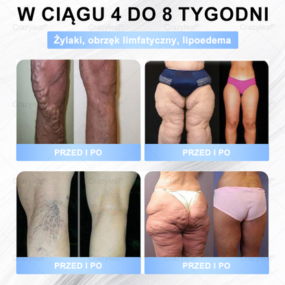 🔥 Extra 30% kedvezmény + ingyenes gyors szállítás!💚 Akár 12–25 kg fogyás 4–8 hét alatt – természetes, biztonságos és klinikailag tesztelt!✅ 180 napos pénzvisszafizetési garancia – kockázat nélkül!